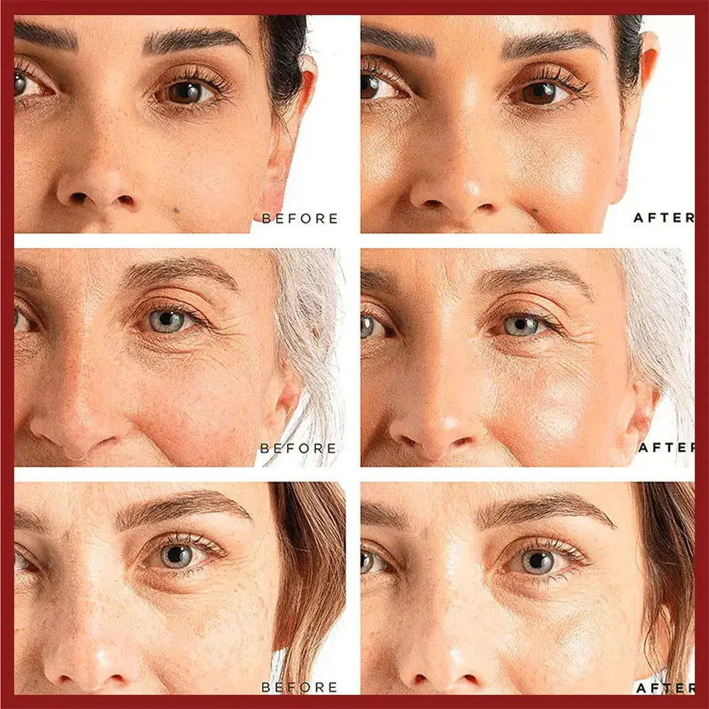 Retinol Wrinkle Remover Face Cream  Anti Aging
