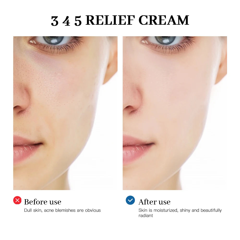 345 Soothing Relief Face Cream
