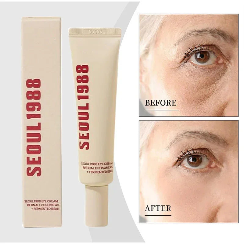 Seoul 1988 Retinol Eye Cream  for Eye Bag and  Dark Circles