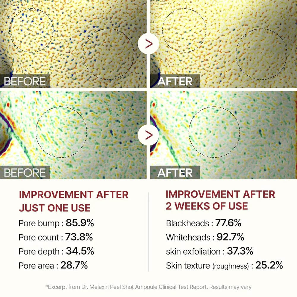 Peel Shot Glow Rice Ampoule Duo