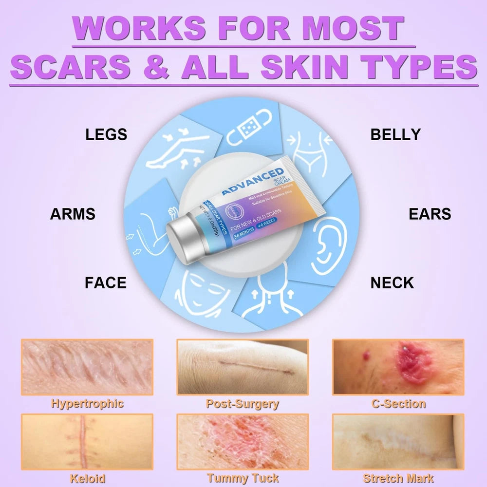 Silicone Scar Cream Scar Gel - Advanced Scar Treatment Keloid Bump Removal
